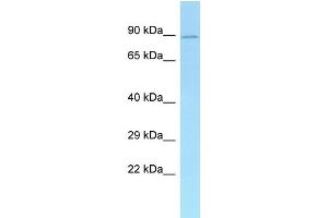 WB Suggested Anti-Add1 Antibody Titration: 1. (alpha Adducin 抗体  (N-Term))