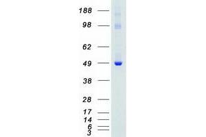 Western Blotting (WB) image for PTK6 Protein tyrosine Kinase 6 (PTK6) (Active) protein (Myc-DYKDDDDK Tag) (ABIN2730083)