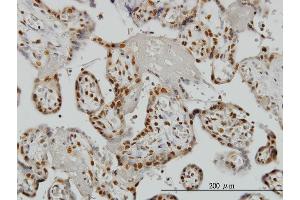 Immunoperoxidase of monoclonal antibody to ZNF265 on formalin-fixed paraffin-embedded human placenta. (ZNF265 抗体  (AA 1-106))