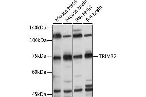 Western blot analysis of extracts of various cell lines, using TRIM32 antibody (ABIN6132735, ABIN6149520, ABIN6149521 and ABIN6222878) at 1:500 dilution. (TRIM32 抗体  (AA 1-280))