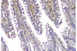 IHC analysis of SQSTM1 using anti-SQSTM1 antibody (ABIN3043937).