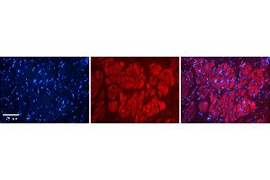Rabbit Anti-NFATC1 Antibody    Formalin Fixed Paraffin Embedded Tissue: Human Adult heart  Observed Staining: Cytoplasmic Primary Antibody Concentration: 1:600 Secondary Antibody: Donkey anti-Rabbit-Cy2/3 Secondary Antibody Concentration: 1:200 Magnification: 20X Exposure Time: 0.