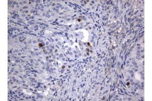 Image no. 4 for anti-Antigen Identified By Monoclonal Antibody Ki-67 (MKI67) (AA 1160-1493) antibody (ABIN1490860)