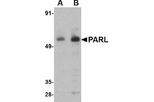 Western Blotting (WB) image for anti-Presenilin Associated, Rhomboid-Like (PARL) (N-Term) antibody (ABIN1031504) (PARL 抗体  (N-Term))
