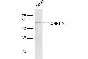 Mouse brain lysates probed with Rabbit Anti-CHRNA7 Polyclonal Antibody, Unconjugated  at 1:500 for 90 min at 37˚C. (CHRNA7 抗体  (AA 441-502))