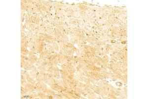 Immunohistochemistry of paraffin embedded rat heart using collagen alpha-1 (V) (ABIN7073547) at dilution of 1: 1800 (400x lens)