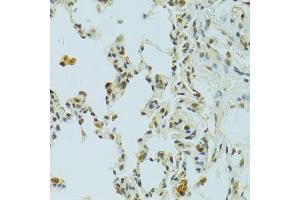 Immunohistochemistry of paraffin-embedded rat lung using RSRC1 antibody (ABIN5974341) at dilution of 1/100 (40x lens). (RSRC1 抗体)
