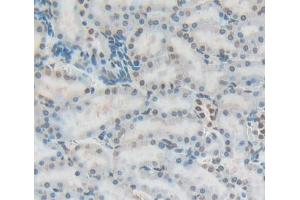 Used in DAB staining on fromalin fixed paraffin- embedded Kidney tissue (Fibrillarin 抗体  (AA 85-274))