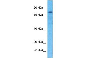 Host:  Rabbit  Target Name:  GPAT2  Sample Type:  Hela Whole Cell lysates  Antibody Dilution:  1. (GPAT2 抗体  (N-Term))