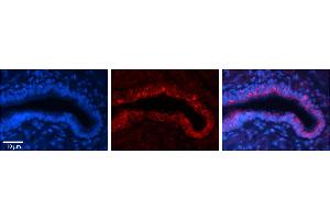 Immunohistochemistry (IHC) image for anti-Ribophorin II (RPN2) (N-Term) antibody (ABIN2782203)