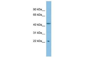 POLR1E antibody used at 1 ug/ml to detect target protein. (POLR1E 抗体)