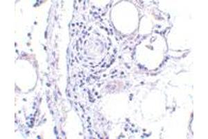 Immunohistochemistry of FABP7 in human breast tissue with FABP7 polyclonal antibody  at 5 ug/mL . (FABP7 抗体  (Internal Region))
