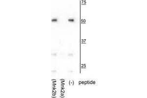 Western blot of HeLa lysate showing specific immunolabeling of the ~52 kDa Mnk2a isoform in the third lane (-). (MKNK2 抗体  (C-Term))