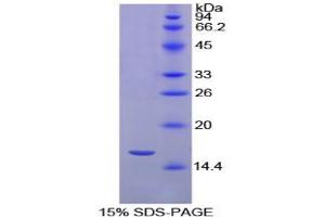 SDS-PAGE analysis of Chicken Transthyretin Protein. (TTR 蛋白)
