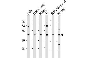 All lanes : Anti-NKX2-1 Antibody (N-term) at 1:2000 dilution Lane 1: Hela whole cell lysate Lane 2: human fetal lung lysate Lane 3: human lung lysate Lane 4: TT whole cell lysate Lane 5: rat thyroid gland lysate Lane 6: mouse lung lysate Lysates/proteins at 20 μg per lane. (NKX2-1 抗体  (N-Term))