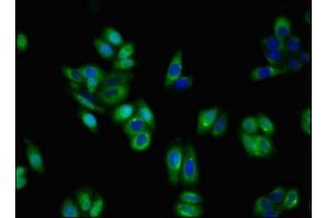 Immunofluorescent analysis of HepG2 cells using ABIN7155192 at dilution of 1:100 and Alexa Fluor 488-congugated AffiniPure Goat Anti-Rabbit IgG(H+L) (TRKA 抗体  (AA 33-208))