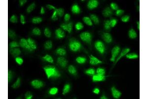 Immunofluorescence analysis of A549 cells using BIRC2 antibody (ABIN6292780). (BIRC2 抗体)