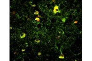Immunofluorescence (IF) image for anti-RAB5A, Member RAS Oncogene Family (RAB5A) (AA 182-211) antibody (ABIN3028967)