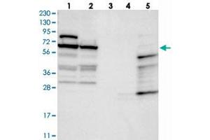 Western blot analysis of Lane 1: RT-4, Lane 2: U-251 MG, Lane 3: Human Plasma, Lane 4: Liver, Lane 5: Tonsil with NOP5/NOP58 polyclonal antibody  at 1:250-1:500 dilution. (NOP58 抗体)