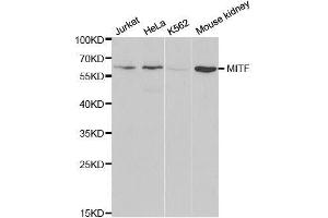 Western blot analysis of extracts of various cell lines, using MITF antibody. (MITF 抗体  (AA 1-280))