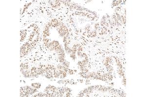 anti-Retinoblastoma Binding Protein 5 (RBBP5) (C-Term) antibody