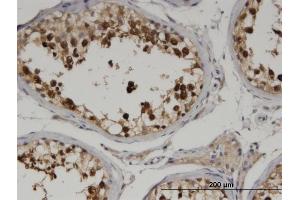 Immunoperoxidase of monoclonal antibody to CKAP2 on formalin-fixed paraffin-embedded human testis. (CKAP2 抗体  (AA 1-161))