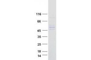 Western Blotting (WB) image for serine Hydroxymethyltransferase 1 (Soluble) (SHMT1) (Transcript Variant 2) protein (Myc-DYKDDDDK Tag) (ABIN2732000)