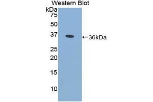 Western Blotting (WB) image for anti-Cytochrome P450, Family 21, Subfamily A, Polypeptide 2 (CYP21A2) (AA 106-389) antibody (ABIN7441886)