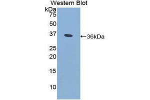 Detection of Recombinant CYP21A2, Human using Polyclonal Antibody to Cytochrome P450 Family 21 Subfamily A Member 2 (CYP21A2) (CYP21A2 抗体  (AA 106-389))