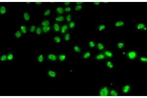Immunofluorescence analysis of A-549 cells using ZNF148 Polyclonal Antibody (ZNF148 抗体)