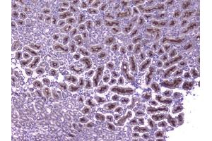 IHC analysis of CCL8 using anti-CCL8 antibody (ABIN6719605). (CCL8 抗体  (AA 24-97))