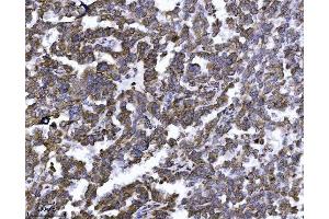 IHC analysis of ERLIN2 using anti-ERLIN2 antibody (ABIN7602582).