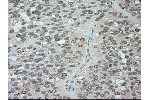 Image no. 5 for anti-Budding Uninhibited By Benzimidazoles 1 Homolog beta (Yeast) (BUB1B) antibody (ABIN1497000) (BUB1B 抗体)