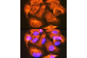 Immunofluorescence analysis of U-2 OS cells using PHKG2 Rabbit pAb  at dilution of 1:100 (40x lens). (PHKG2 抗体  (AA 237-406))