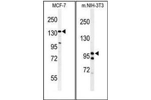 (LEFT) Western blot analysis of TAF2 Antibody (C-Term) in MCF-7 cell line lysates (35µg/lane). (TAF2 抗体  (C-Term))
