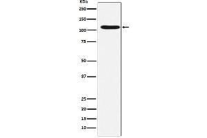 Western blot analysis of HIRA expression in HeLa cell lysate.