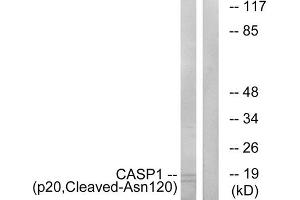 Western blot analysis of extracts from rat eye cells, using CASP1 (p20, Cleaved-Asn120) antibody. (Caspase 1 抗体  (Cleaved-Asn120, Internal Region))