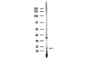 anti-RAB30, Member RAS Oncogene Family (RAB30) (C-Term) antibody