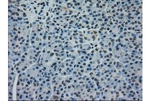 Immunohistochemical staining of paraffin-embedded pancreas tissue using anti-MAPK1mouse monoclonal antibody. (ERK2 抗体)