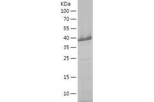 Western Blotting (WB) image for Mdm4-binding Protein (MDM4) (AA 1-300) protein (His tag) (ABIN7123868) (MDM4-binding Protein Protein (AA 1-300) (His tag))