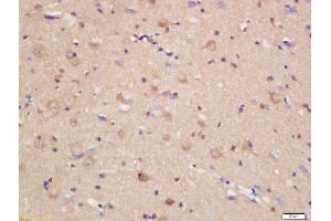 Formalin-fixed and paraffin embedded rat brain labeled with Rabbit Anti-JAMC Polyclonal Antibody, Unconjugated (ABIN1386406) at 1:200 followed by conjugation to the secondary antibody and DAB staining (JAM3 抗体  (AA 31-130))