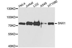 Western blot analysis of extracts of various cell lines, using SNX1 antibody. (Sorting Nexin 1 抗体  (AA 1-150))