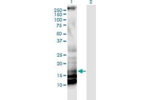 Western Blot analysis of IL17A expression in transfected 293T cell line by IL17A monoclonal antibody (M01), clone 3G5. (Interleukin 17a 抗体  (AA 24-133))