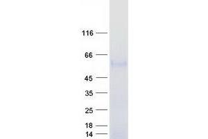 Validation with Western Blot (BACE2 Protein (Transcript Variant A) (Myc-DYKDDDDK Tag))