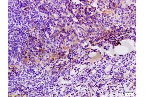 Formalin-fixed and paraffin embedded mouse colon carcinoma labeled with Anti-GPR49/LGR5 Polyclonal Antibody, Unconjugated (ABIN737916) at 1:200 followed by conjugation to the secondary antibody and DAB staining. (LGR5 抗体  (AA 810-907))