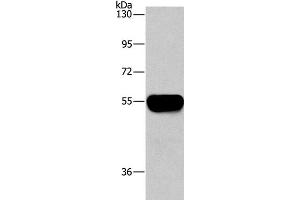 Western Blot analysis of Human plasma tissue using AHSG Polyclonal Antibody at dilution of 1:1450 (Fetuin A 抗体)