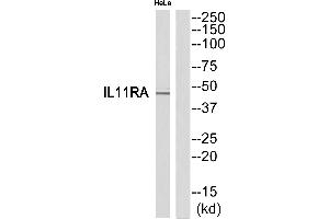 Western blot analysis of extracts from HeLa cells, using IL11RA antibody. (IL11RA 抗体  (C-Term))