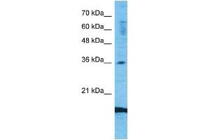 Host:  Rabbit  Target Name:  CCL18  Sample Type:  Fetal Lung lysates  Antibody Dilution:  1. (CCL18 抗体  (Middle Region))