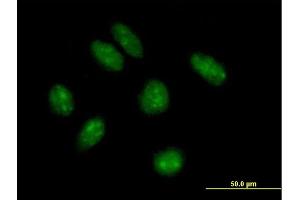 Immunofluorescence of purified MaxPab antibody to KIAA1456 on HeLa cell. (KIAA1456 抗体  (AA 1-367))