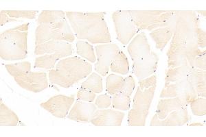 Detection of AMFR in Human Skeletal muscle Tissue using Polyclonal Antibody to Autocrine Motility Factor Receptor (AMFR)
